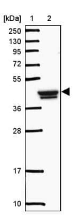 GCNT7 Antibody, Novus Biologicals 25 &mu;L | Buy Online | Novus Biologicals | Fisher Scientific