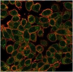 GCR2 Mouse anti-Human, Clone: PCRP-ECD-1D10, Novus Biologicals 100 &mu;g;