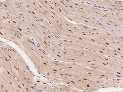 GCR2 Antibody, Novus Biologicals 100 &mu;g | Buy Online | Novus Biologicals | Fisher Scientific