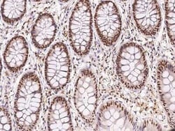 GCR2 Antibody, Novus Biologicals 100 &mu;g | Buy Online | Novus Biologicals | Fisher Scientific