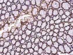 GCR2 Antibody, Novus Biologicals 100 &mu;g | Buy Online | Novus Biologicals | Fisher Scientific
