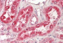 GCSH Antibody, Novus Biologicals 100 &mu;L; Unconjugated:Antibodies, Polyclonal