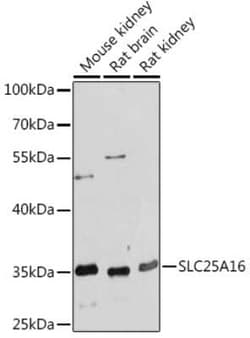GDC Rabbit anti-Human, Mouse, Rat, Polyclonal, Novus Biologicals 100 &mu;g;