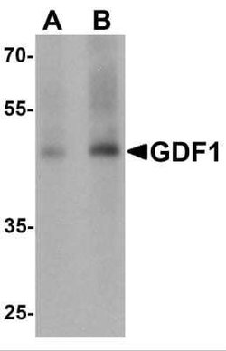 GDF-1 Antibody - BSA Free, Novus Biologicals 0.1 mg | Buy Online | Novus Biologicals | Fisher Scientific