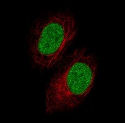 GDF-15 Antibody (CL0328), Novus Biologicals 0.1 mL, Unconjugated:Antibodies,