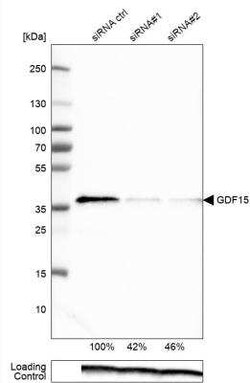 GDF-15 Antibody (CL0328), Novus Biologicals 0.1 mL, Unconjugated:Antibodies,