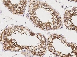 GDF-3 Rabbit anti-Human, Clone: 10, Novus Biologicals 50 &mu;g; Unconjugated:Antibodies,
