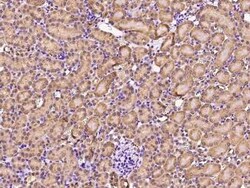 GDF-3 Antibody, Novus Biologicals 100 &mu;g; Unconjugated:Antibodies, Polyclonal