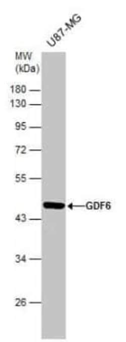GDF-6/BMP-13 Antibody, Novus Biologicals 100 &mu;g | Buy Online | Novus Biologicals | Fisher Scientific