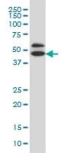 GDI1 Antibody (1H3), Novus Biologicals 0.1 mg, Unconjugated:Antibodies,