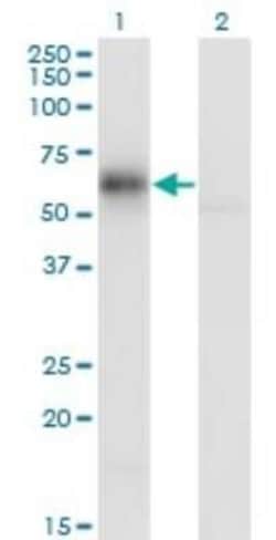 GDI1 Antibody (1H3), Novus Biologicals 0.1 mg, Unconjugated:Antibodies,