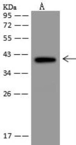 GDPGP1 Antibody, Novus Biologicals 50 &mu;g; Unconjugated:Antibodies, Polyclonal