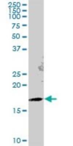 GEMIN6 Antibody, Novus Biologicals 0.05 mg | Buy Online | Novus Biologicals | Fisher Scientific