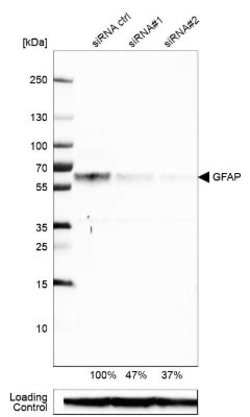 GFAP Antibody (CL2713), Novus Biologicals 25 &mu;L; Unconjugated:Antibodies,