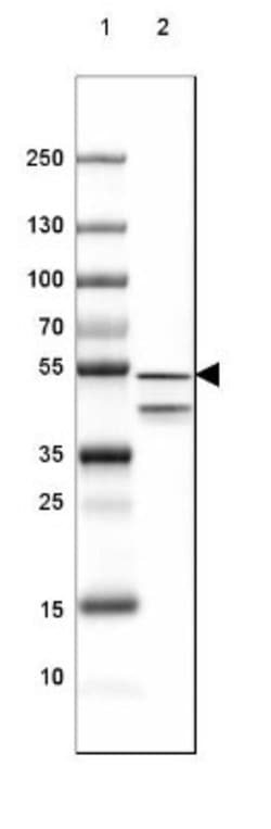 GFAP Antibody (CL2713), Novus Biologicals 25 &mu;L; Unconjugated:Antibodies,