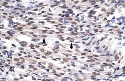 GFI1B Rabbit anti-Human, Polyclonal, Novus Biologicals 0.1ml; Unconjugated:Antibodies,