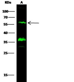 GFR alpha-2/GDNF R alpha-2 Rabbit anti-Human, Clone: 104, Novus Biologicals