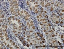 GGA1 Antibody (3F11), Novus Biologicals 0.1 mg | Buy Online | Novus Biologicals | Fisher Scientific