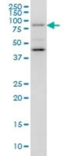 GGA1 Antibody (3F11), Novus Biologicals 0.1 mg | Buy Online | Novus Biologicals | Fisher Scientific