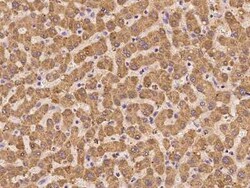 GGCX Antibody, Novus Biologicals:Antibodies:Primary Antibodies