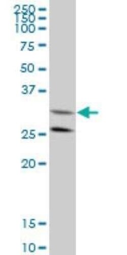 GGPS1 Antibody (1C3), Novus Biologicals 0.1 mg | Buy Online | Novus Biologicals | Fisher Scientific