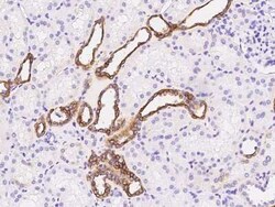 GGT1 Antibody, Novus Biologicals 100 &mu;g, Unconjugated:Antibodies, Polyclonal