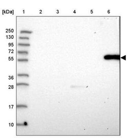 Gamma-glutamyltransferase 2 Antibody, Novus Biologicals 25 &mu;L, Unconjugated:Antibodies,