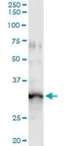 GIMAP5 Antibody (1E10), Novus Biologicals 0.1 mg | Buy Online | Novus Biologicals | Fisher Scientific