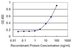 GIMAP5 Antibody (1E10), Novus Biologicals 0.1 mg | Buy Online | Novus Biologicals | Fisher Scientific