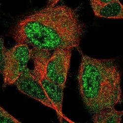 GIMAP6 Antibody, Novus Biologicals GIMAP6 Antibody; Unconjugated; 100 &mu;L:Antibodies,