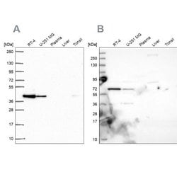 GIPC1 Antibody, Novus Biologicals:Antibodies:Primary Antibodies