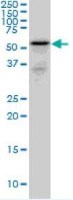 Novus Biologicals GIPC2 Antibody, Novus Biologicals 0.05 mg | Buy Online | Novus Biologicals&trade; | Fisher Scientific