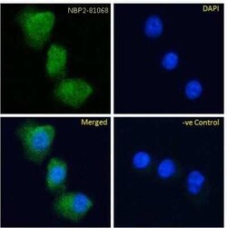 GIPR, Rabbit anti-Human,Mouse,Rat,Canine, Clone: Gipg013, Novus Biologicals:Antibodies:Primary