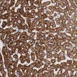 GIT1 Antibody, Novus Biologicals 0.1 mL | Buy Online | Novus Biologicals | Fisher Scientific