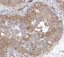 GIT1 Antibody, Novus Biologicals 0.1 mL | Buy Online | Novus Biologicals | Fisher Scientific