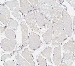 GIT1 Antibody, Novus Biologicals 0.1 mL | Buy Online | Novus Biologicals | Fisher Scientific