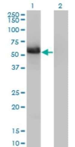 GIT2 Antibody (3B5-B9), Novus Biologicals 0.1 mg, Unconjugated:Antibodies,