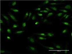 GIT2 Antibody (M1), Novus Biologicals 0.1 mg | Buy Online | Novus Biologicals | Fisher Scientific