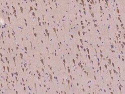 GKAP/DLGAP1 Antibody, Novus Biologicals:Antibodies:Primary Antibodies