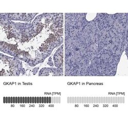 GKAP1 Antibody, Novus Biologicals 100 &mu;g; Unconjugated:Antibodies, Polyclonal