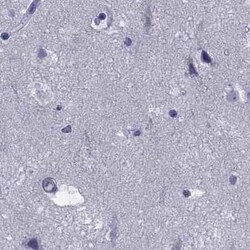 GKAP1 Antibody, Novus Biologicals 100 &mu;g; Unconjugated:Antibodies, Polyclonal