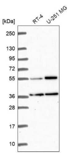 GKAP1 Antibody, Novus Biologicals 100 &mu;g; Unconjugated:Antibodies, Polyclonal