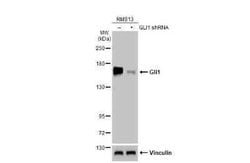 GLI-1 Antibody (HL247), Novus Biologicals 100 &mu;g | Buy Online | Bio-Techne | Fisher Scientific