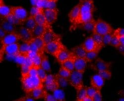 GLI-1 Antibody (JF09-08), Novus Biologicals 100&mu;L:Antibodies, Monoclonal