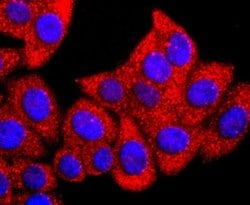 GLI-1 Antibody (JF09-08), Novus Biologicals 100&mu;L:Antibodies, Monoclonal