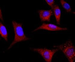 GLI-1 Antibody (JF09-08), Novus Biologicals 100&mu;L:Antibodies, Monoclonal