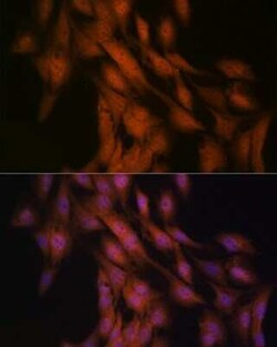 GLI-3 Rabbit anti-Human, Mouse, Rat, Clone: 8B1E2, Novus Biologicals:Antibodies:Primary