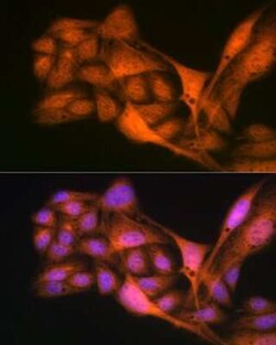 GLI-3 Rabbit anti-Human, Mouse, Rat, Clone: 8B1E2, Novus Biologicals:Antibodies:Primary