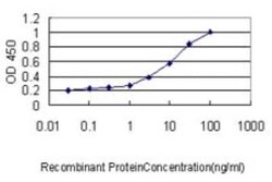 GLMN Antibody (1C12), Novus Biologicals 0.1 mg | Buy Online | Novus Biologicals | Fisher Scientific