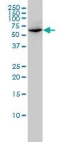 GLMN Antibody (1C12), Novus Biologicals 0.1 mg | Buy Online | Novus Biologicals | Fisher Scientific